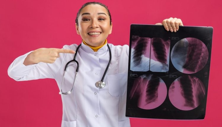 WHAT IS LUNG CANCER EXPLAINED visual data 8